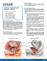 Anterior Repair