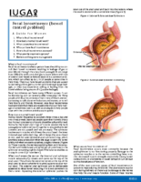 Faecal Incontinence