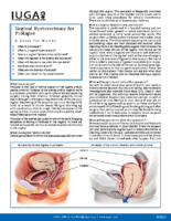 Hysterectomy