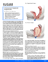 Uterosacral Ligament Suspension